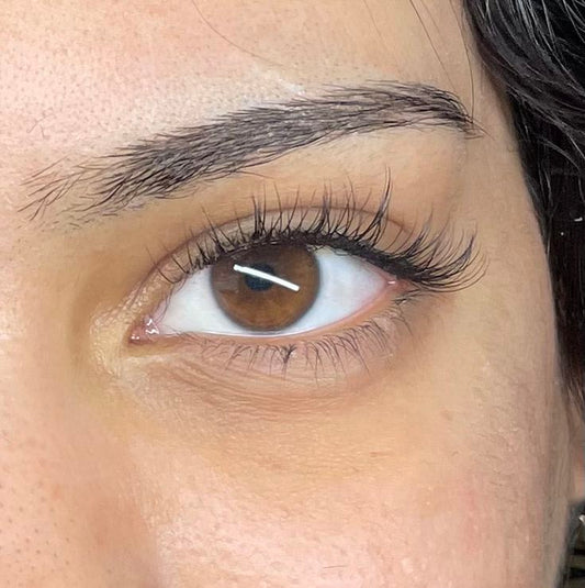 Gluma™- Butterfly Flutter